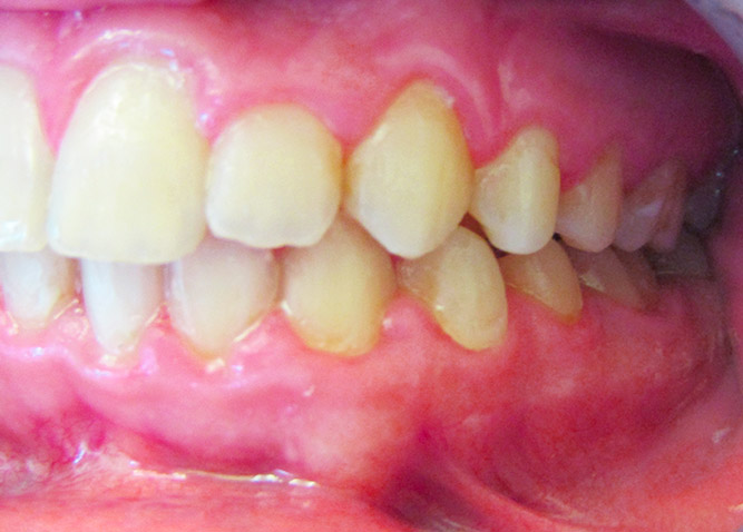 Studio Dentistico Marina Fiocca - Caso ortodonzia