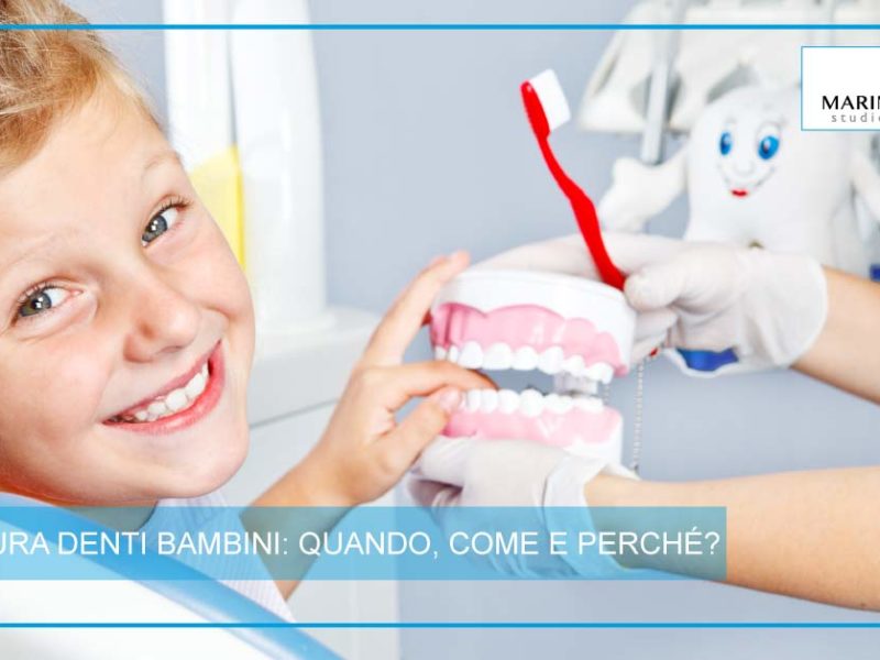 Sigillatura denti bambini | Studio Dentistico Marina Fiocca | Dentista a Cremella