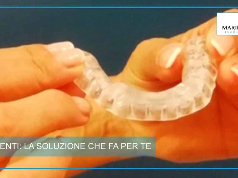 bite_ai_denti