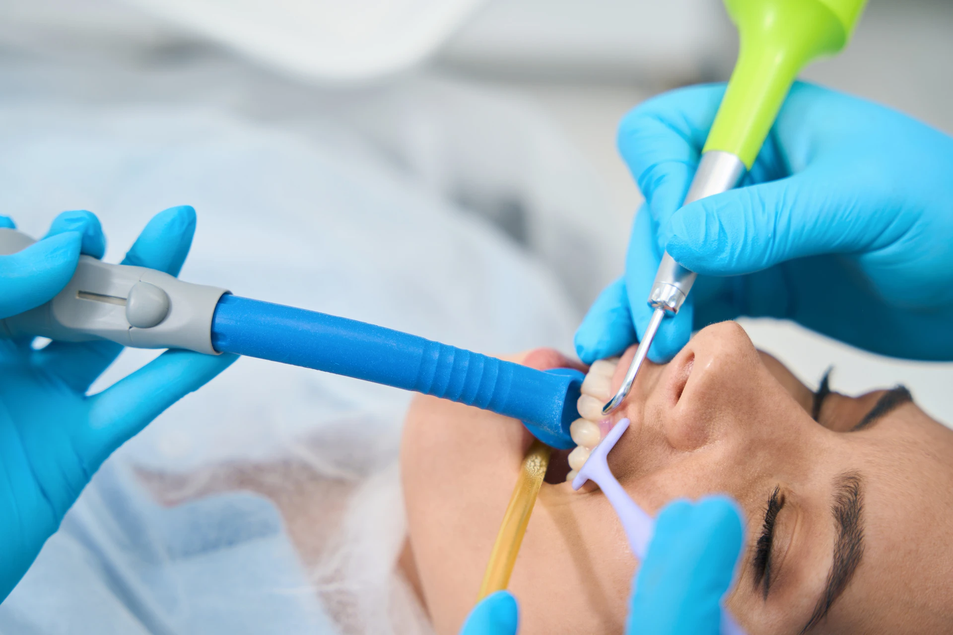 Pulizia dentale con Airflow